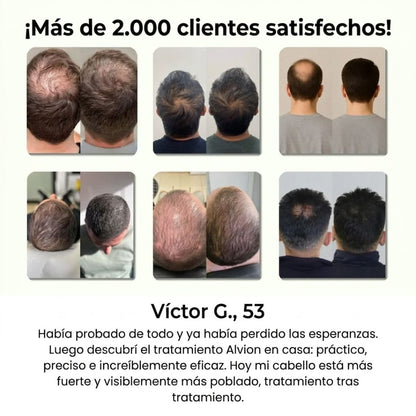 ¿Pierdes cabello cada día? Este sistema lo detiene en semanas — sin Minoxidil